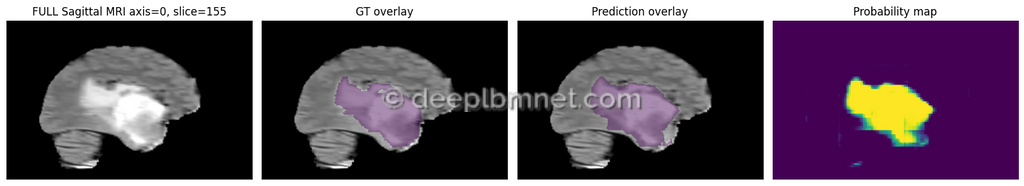 LBMNet is a new architecure for IMedical Imaging Segmentation base in the lattice Boltzmann Method