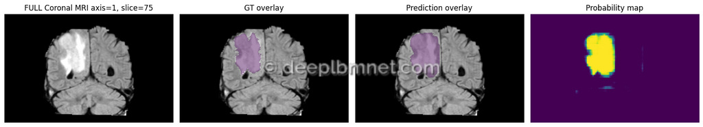 LBMNet is a new architecure for IMedical Imaging Segmentation base in the lattice Boltzmann Method