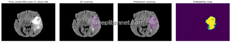 3D Medical Image Segmentation